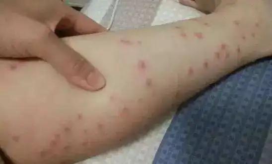 泰国青草止痒膏正品方便携带,泰国进口青草膏居家旅游必备