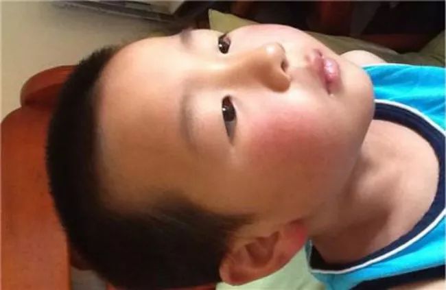 儿科医生刘鉴肠系膜淋巴结,儿科医生刘鉴腹部淋巴结肿大