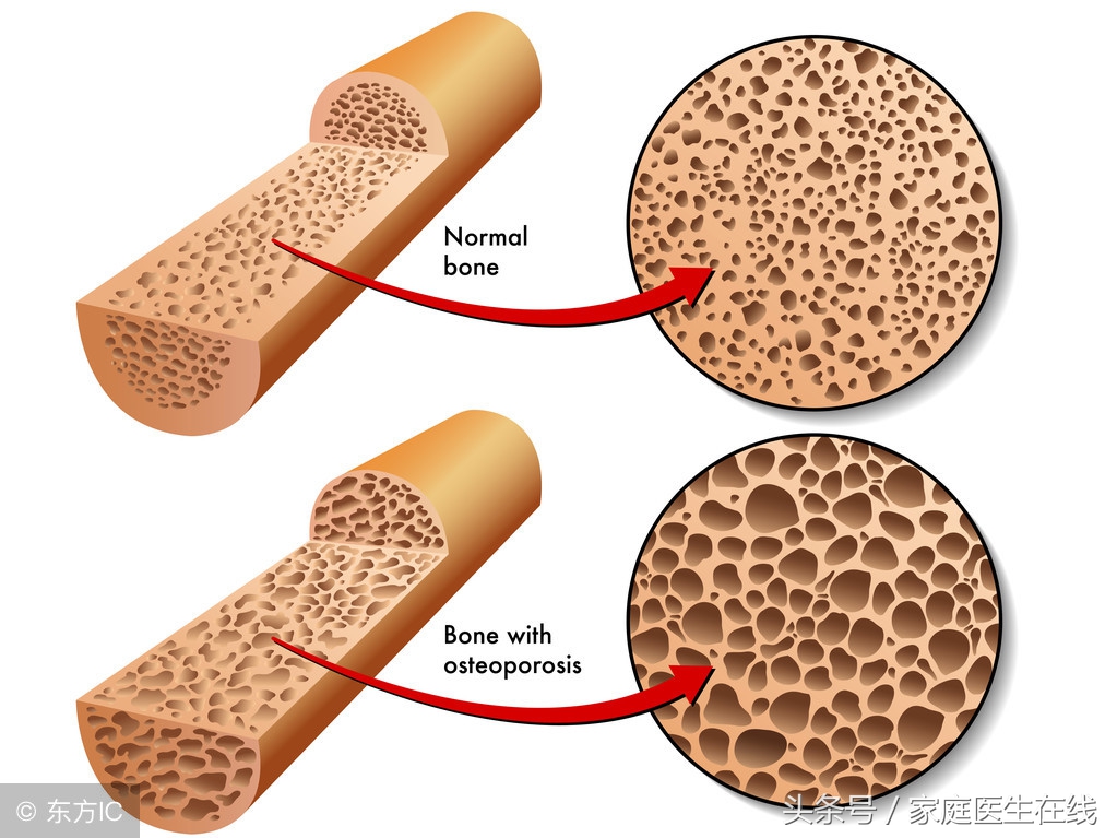 自测缺钙的方法,如何自测是否儿童缺钙缺锌