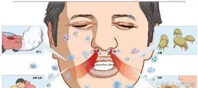 过敏君科普,过敏君的尴尬人生