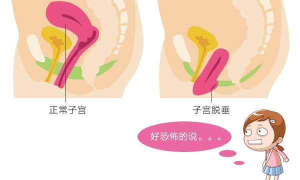 按照这三点做,远离产后阴道松弛!