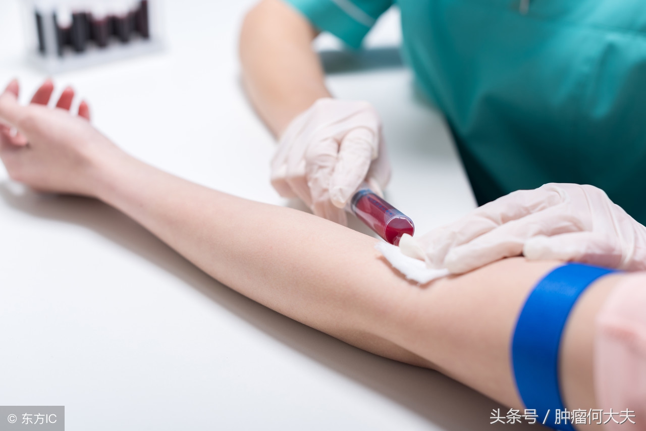 白细胞没有持续性增高是白血病吗,白细胞异常增高是白血病吗