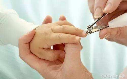 指甲变脆有竖纹怎么办,指甲变脆容易折断是什么原因