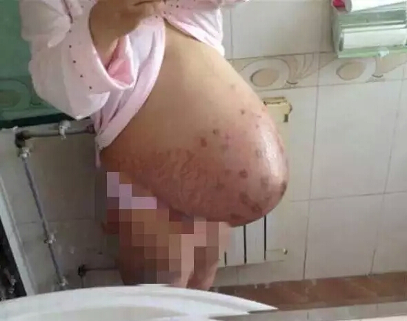 23岁产妇生下四胞胎后续,深圳孕妇产子事件