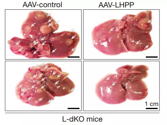 肝癌大突破！拉斯克奖大牛发现全新抑癌蛋白
