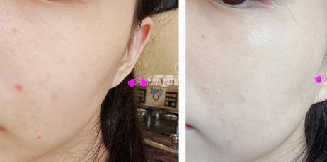 油皮bb霜好用排行榜推荐女,蒂佳婷银管bb霜黄黑皮测评