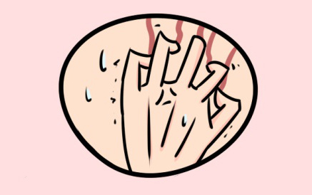 春天湿疹中医治疗法,春季湿疹中药调理