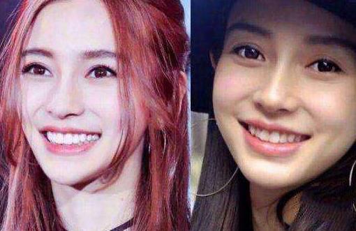 高圆圆戴牙套前后对比,高圆圆牙齿矫正牙套戴了几年