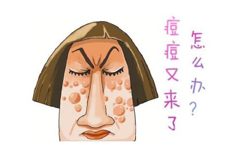 祛痘痘神器女士,治痘痘神器买一送一