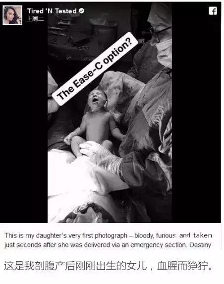 顺产和剖腹产哪个痛,剖腹产痛还是顺产痛