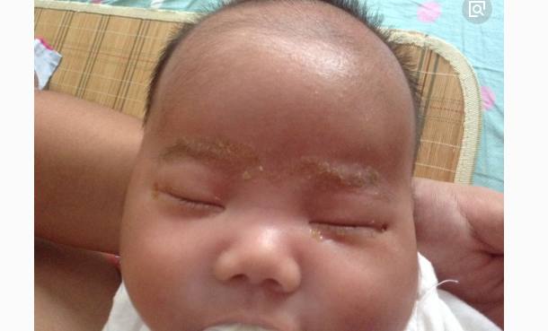 盘点：百天婴儿最需要注意的6大问题，第6条家长一定要重视！