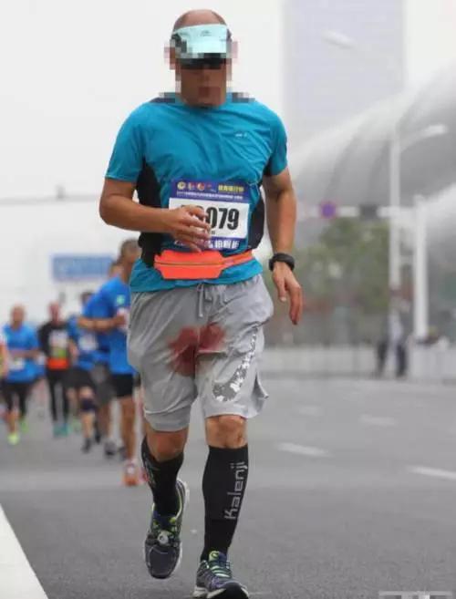 比惨现场！哈佛妹子马拉松跑到鲜血淋漓还有人磨破的部位不可描述