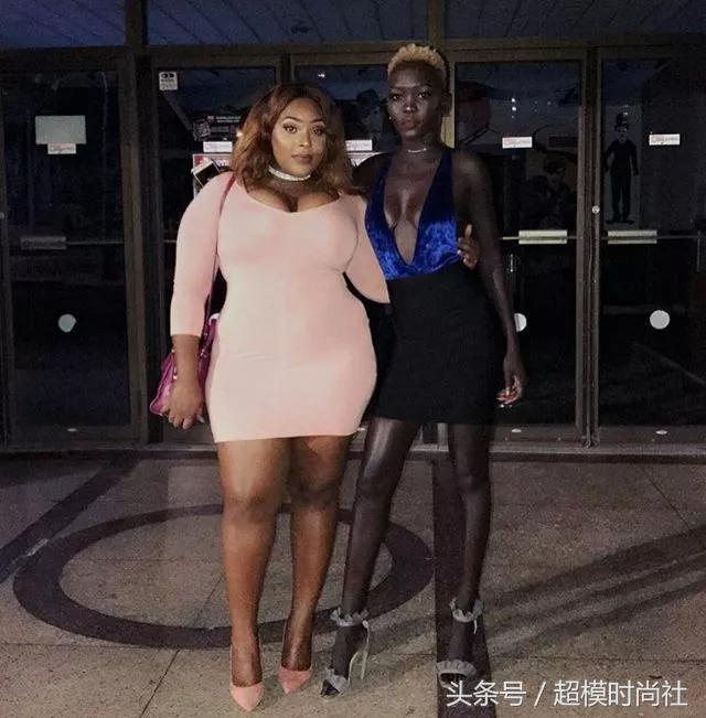 她连牙龈都是乌黑的!但她却敢反歧视,活成INS大热的模特女王