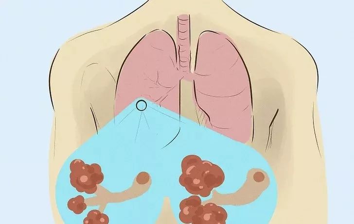 生气对女性的危害致癌,过度发脾气会引起哪些疾病