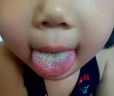 娃娃胃口不好抵抗力低怎么办,娃娃不爱吃饭胃口差怎么办