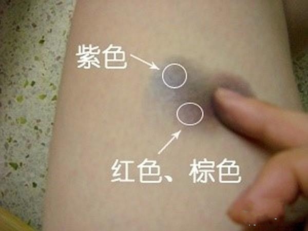 装病请假必备技巧