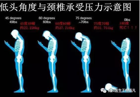 颈椎病都是颈椎曲度变直吗,颈椎生理曲度变直是颈椎病吗