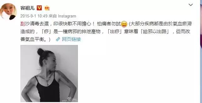 完全没想到!明星也如此痴迷刮痧和拔火罐…