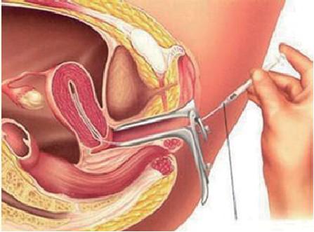 有人因为宝宝而幸福，有人因宝宝失去了幸福