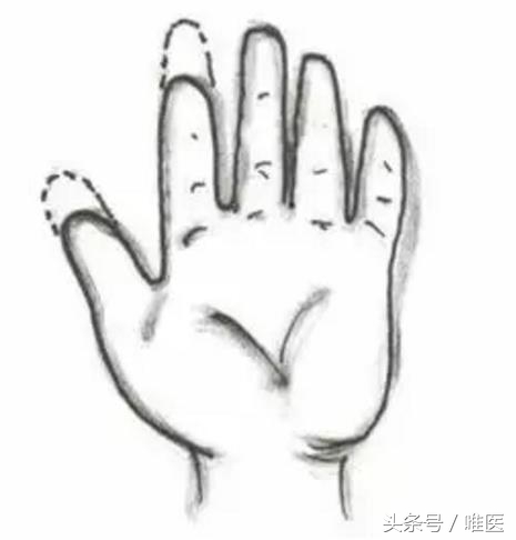 缓解截肢后疼痛的办法,截肢后的幻肢痛怎么解决日常生活