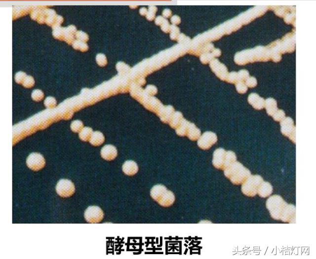 真菌微生物国标检测方法,微生物真菌检验