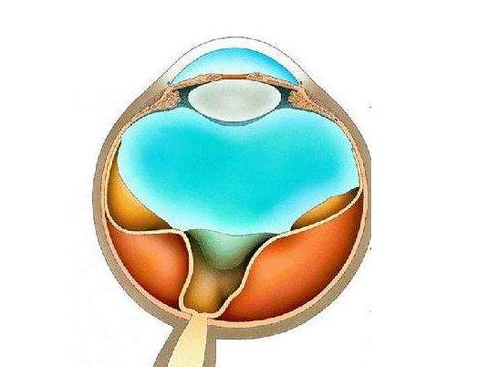 视网膜脱落是最严重的眼科疾病吗,视网膜脱落怎么预防应该注意什么