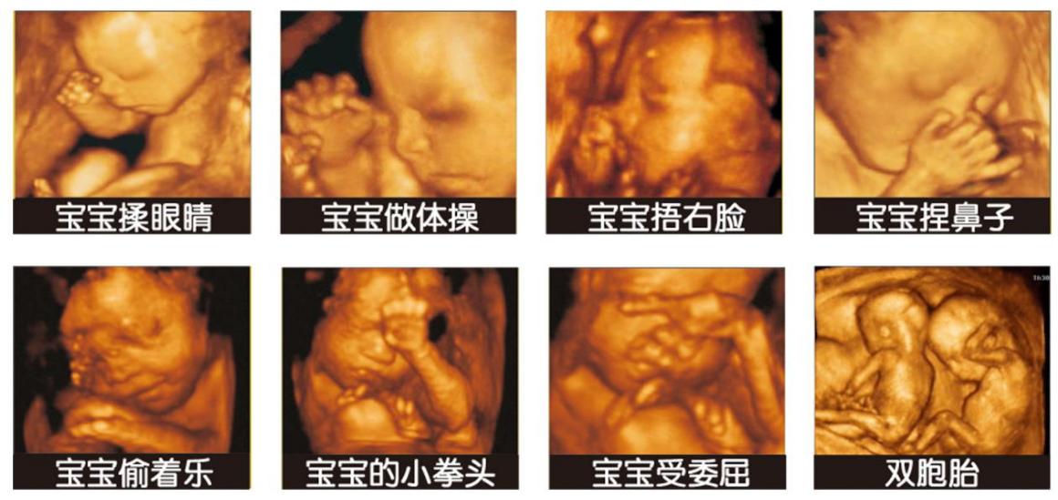 十月怀胎要闯这九关，看看孕期的你现在闯到第几关了?