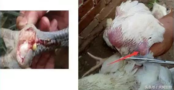 万病之源始于毒素,万病之源起于情志不畅