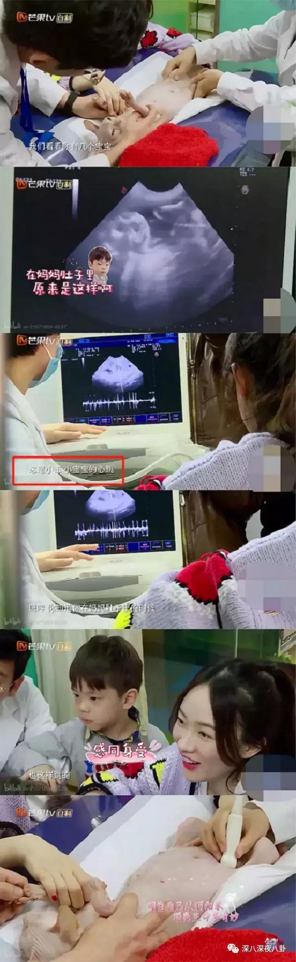 霍思燕为什么称小短手,霍思燕短手照片