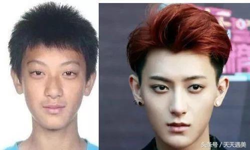 大方承认割双眼皮的明星,戚薇旗下明星