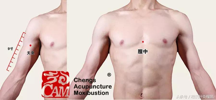 程凯养生说血瘀按什么穴位,程凯养生说血瘀治疗方法