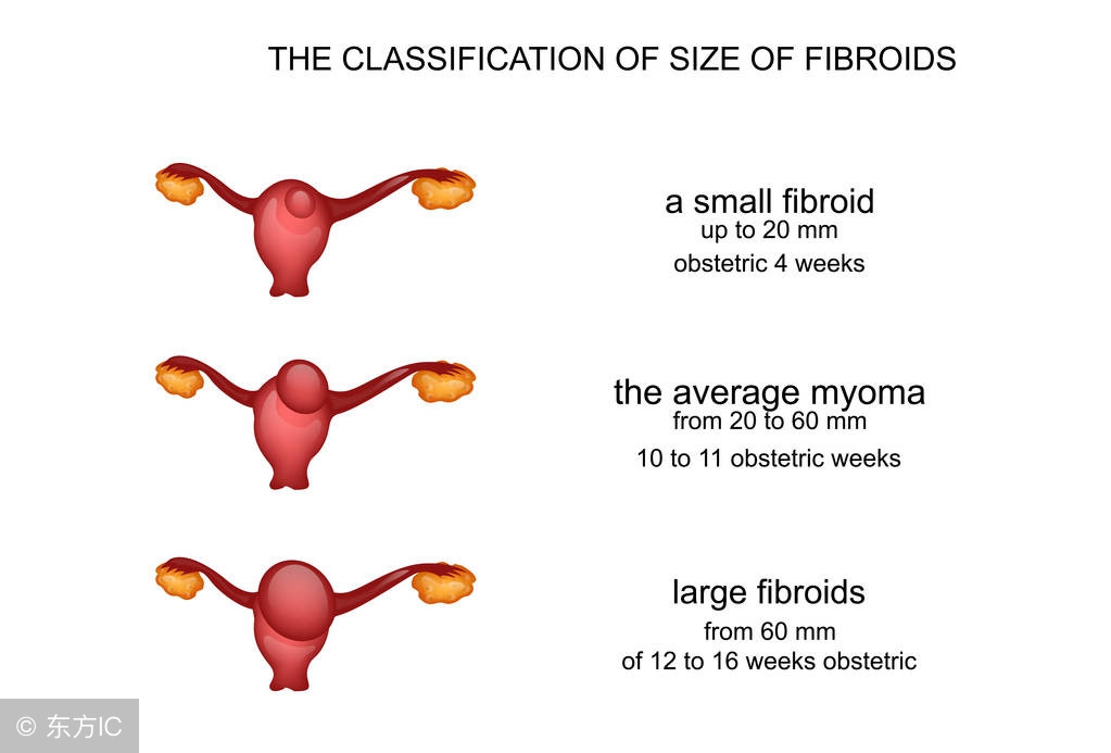 宫颈炎常见两种病原体,宫颈炎性疾病怎么预防