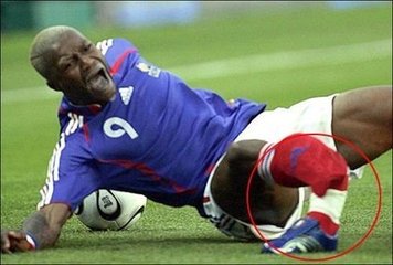 足球守门被爆头,足球守门员被爆头