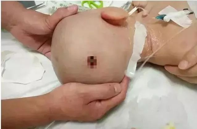 儿童摔到后脑勺几天是危险期,小孩摔到后脑勺什么症状比较危险