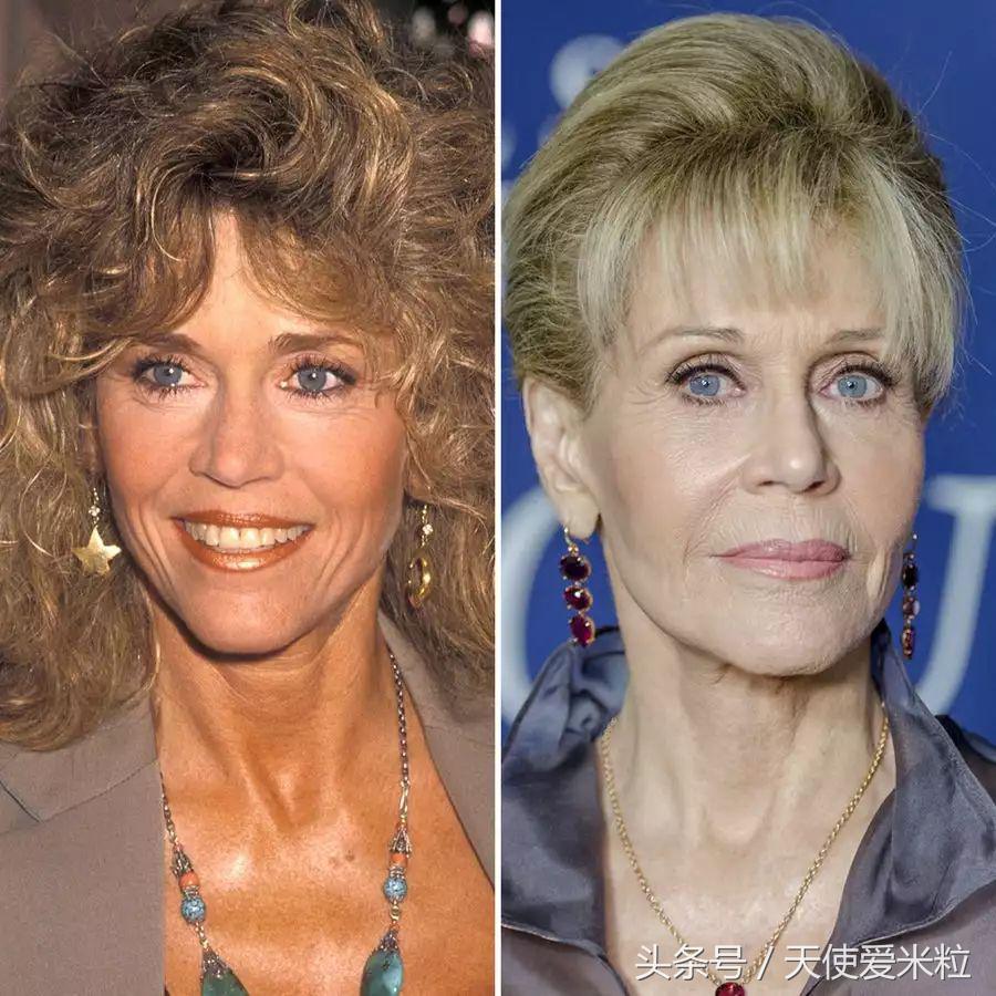 最新的整形塑形手术,7种整形手术可以尝试