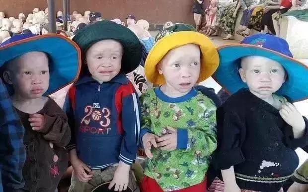 生吃它可以强身健体？这些“民间偏方”真是分分钟要人命！