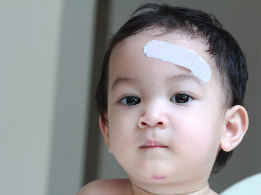 小朋友头被碰了一个包,小孩头上被车撞一个大包怎么办