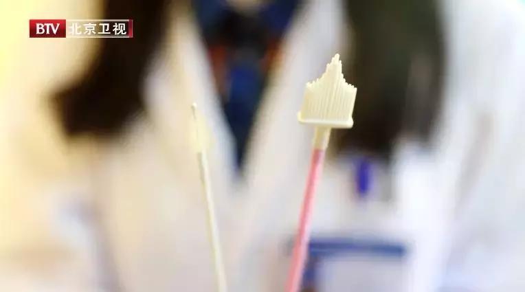 女人腰痛是妇科病引起的吗,女性下腹部隐痛腰痛是不是宫颈癌