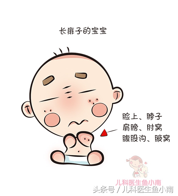 新生儿热疹和湿疹的预防与护理,宝宝湿疹热疹如何预防及护理