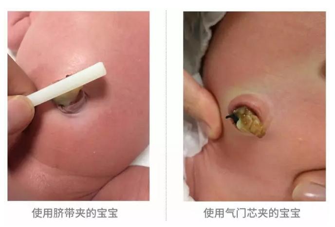 宝宝脐带护理看这里就够了!