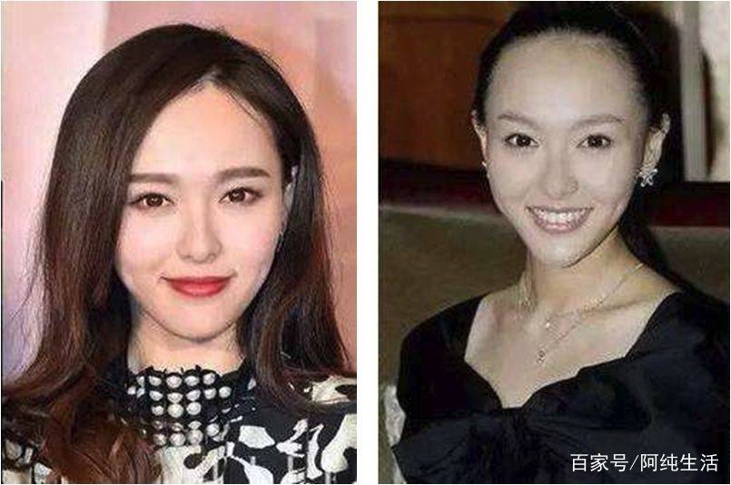 别让秃头误了你的颜值,不要让发际线毁了