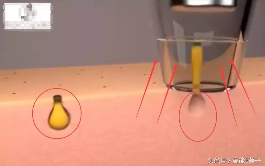 别傻了！蔡徐坤、Angelababy都根治不掉的黑头，微商神器能去除？