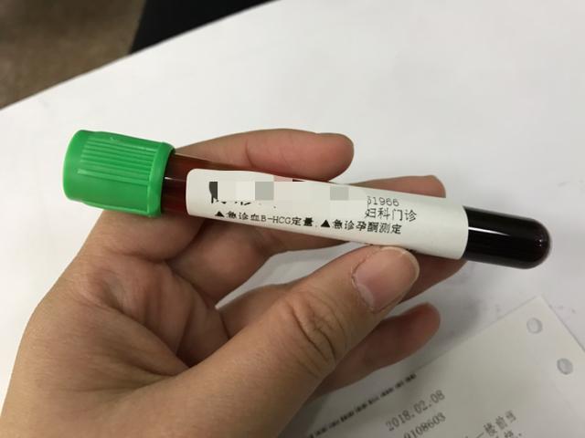 查人绒毛膜促性腺激素标准,查人绒毛膜促性腺激素临床诊断