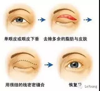 医美有哪些比较有用的,医美套路有多深爱美的你需警惕