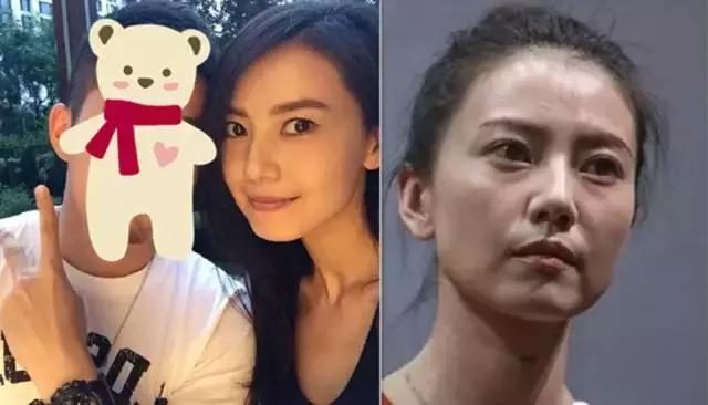 为什么美颜相机都去不掉法令纹,为什么法令纹怎么弄都去不掉