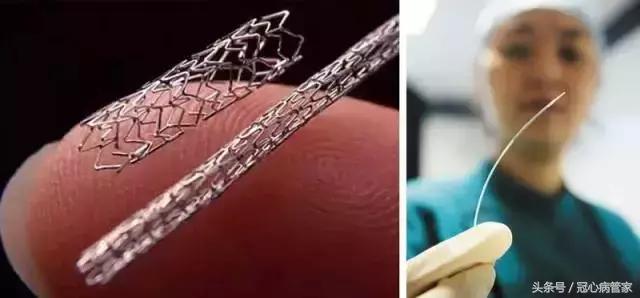 冠心病支架术后胳膊疼痛难忍,做过心脏支架手术后背疼痛正常吗