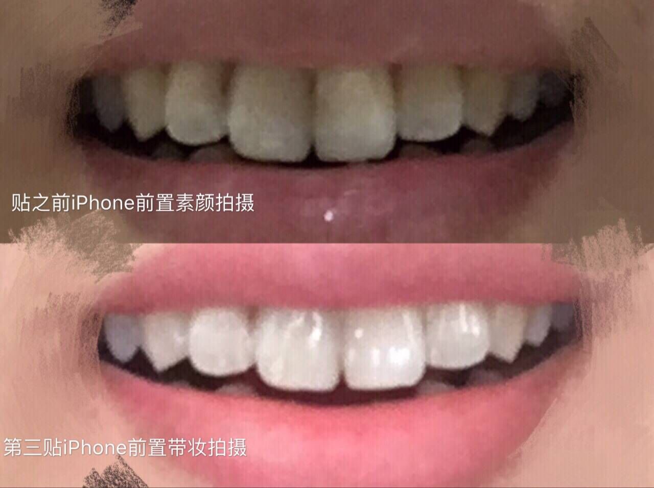 和一口大黄牙说拜拜，佳洁士3D炫白牙贴大陆版真实测评！