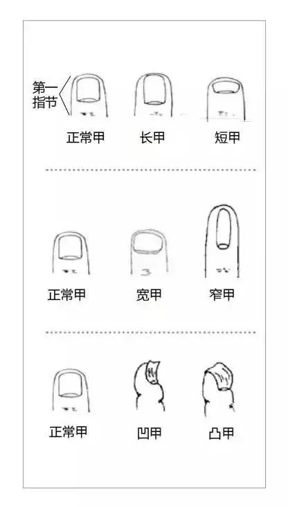 发现指甲异常,警惕疾病上门!