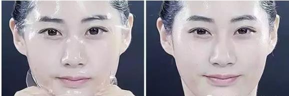 生物纤维膜和蚕丝膜哪个好,透明面膜真的有那么好吗