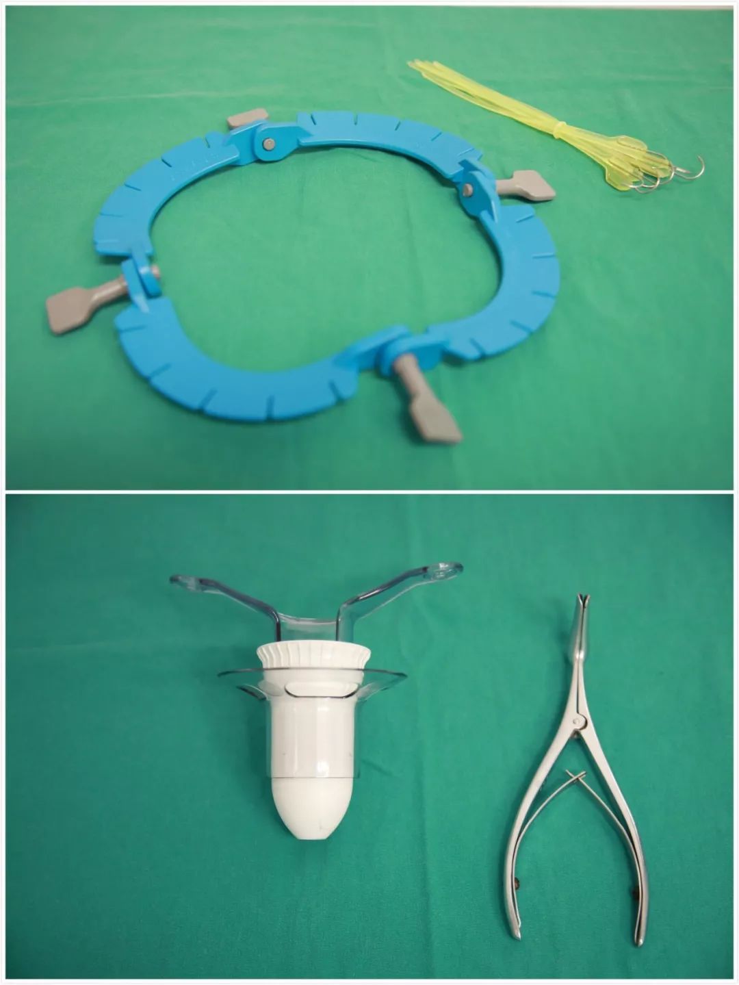 灯泡进肛门引发万人关注，“会诊”结果靠谱么？